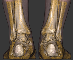3D image